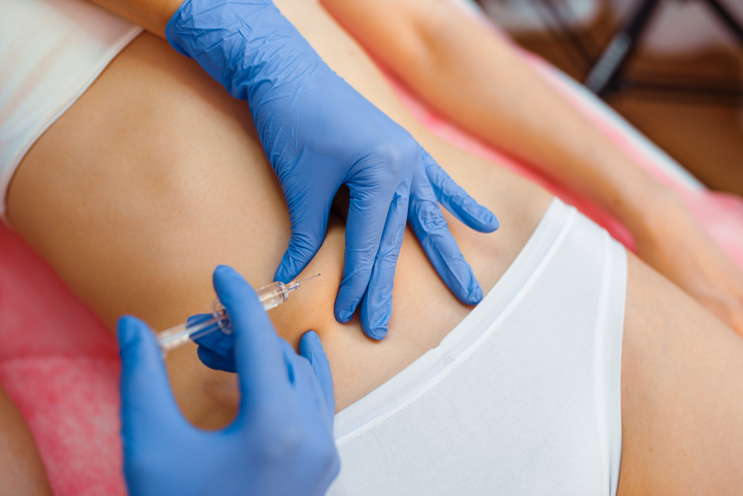 Intradermoterapia em Clínica de Estética em Salvador