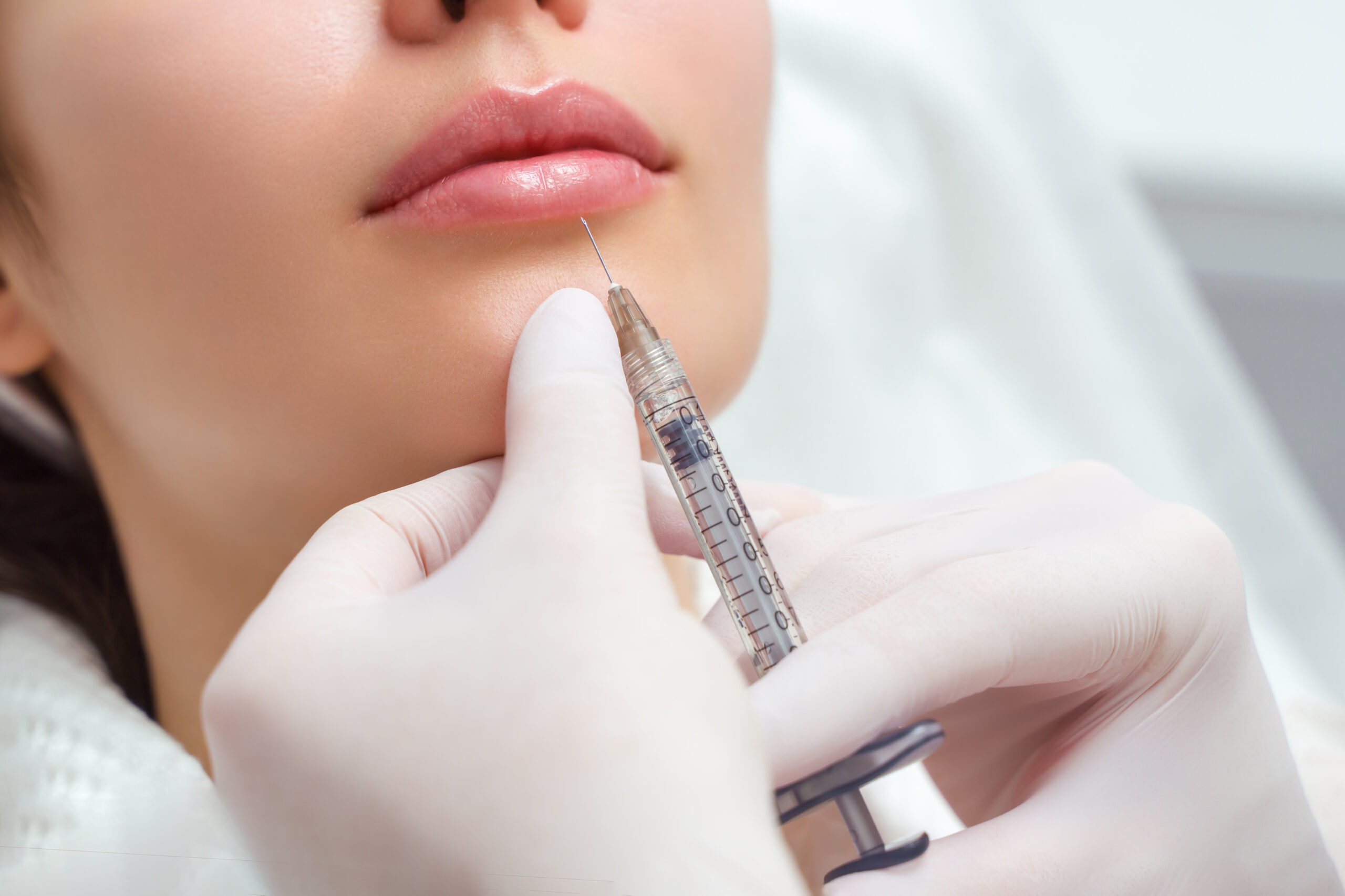 Preenchimento Labial em Clínica de Estética em Salvador